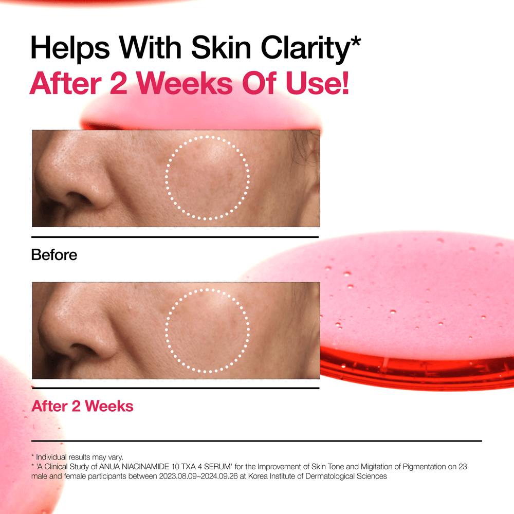 ANUA 10% Niacinamide + 4% Tranexamic Acid Serum (30ml)